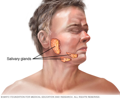 Salivary gland tumors | UM Health-Sparrow